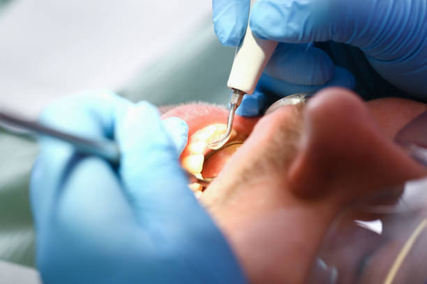 Best Urgent Tooth Repair  in Drexel, OH