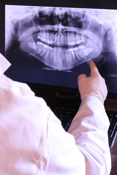 Best Knocked-Out Tooth Emergency  in Drexel, OH