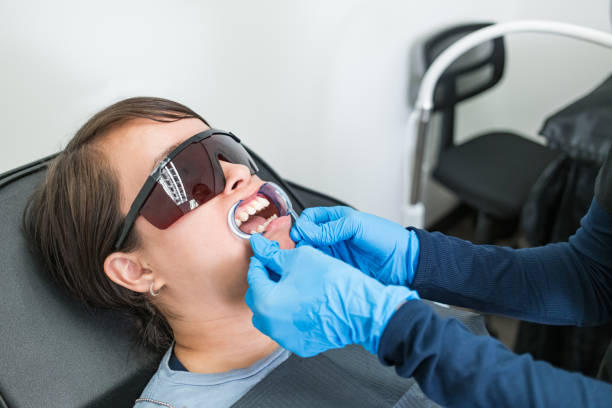 Best Teeth Whitening  in Drexel, OH