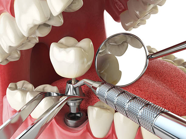 Best Emergency Gum Pain Relief  in Drexel, OH